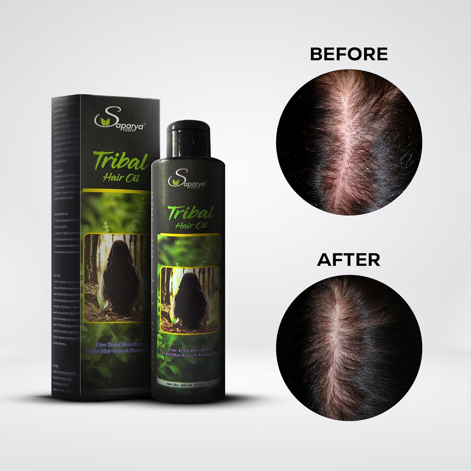 Saparya Vedic Tribal-HAIR GROWTH OIL | For Men & Women | With Rose mary (True indigo), bringaraj, Onion, Neem, Amla & Rare hair growth herbs in coconut oil | strenthens hair roots, prevents hair breakage, aids hair growth & stops dandruff | 200 ml